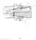 Fig. 20 - Methods and apparatus for endovascular heart valve replacement comprising tissue grasping elements