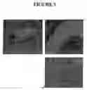 Fig. 04 - Production of tissue engineered heart valves
