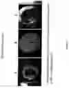 Fig. 22 - Production of tissue engineered heart valves