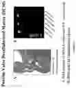 Fig. 23 - Production of tissue engineered heart valves