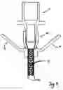 Fig. 04 - Shape-memory port-access tube
