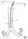 Fig. 07 - Shape-memory port-access tube
