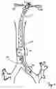 Fig. 12 - Shape-memory port-access tube