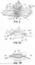 Fig. 03 - Multi-lumen mold for intervertebral prosthesis and method of using same