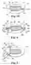 Fig. 04 - Multi-lumen mold for intervertebral prosthesis and method of using same