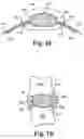 Fig. 07 - Multi-lumen mold for intervertebral prosthesis and method of using same