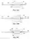 Fig. 09 - Multi-lumen mold for intervertebral prosthesis and method of using same