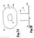Fig. 03 - Hernial prosthesis for intraprosthetic fixation