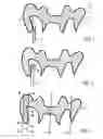 Fig. 02 - Method, computer, computer program and computer-readable medium relating to the examination of data records for dental prosthesis parts