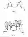 Fig. 06 - Method, computer, computer program and computer-readable medium relating to the examination of data records for dental prosthesis parts