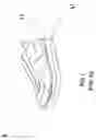 Fig. 02 - Leg length discrepancy corrective sock