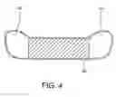 Fig. 07 - Patient transfer mattress having connectable segments