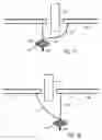 Fig. 08 - Winch for raising and lowering persons