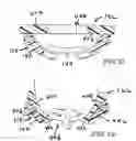 Fig. 19 - Head support apparatus for spinal surgery