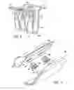 Fig. 06 - Silencer plating for fasteners