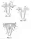 Fig. 07 - Silencer plating for fasteners