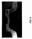 Fig. 10 - High velocity forming of local features using a projectile