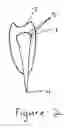 Fig. 03 - Knife apparatus