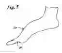 Fig. 04 - Anterior transverse arch support with phalanges grip