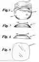 Fig. 05 - Anterior transverse arch support with phalanges grip