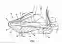 Fig. 02 - Dorsiflexion shoe