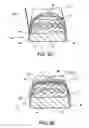 Fig. 03 - Dorsiflexion shoe