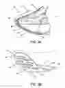 Fig. 04 - Dorsiflexion shoe