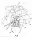 Fig. 04 - Support Device for Controlling and Protecting Plant Growth