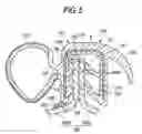 Fig. 05 - Long trim member for vehicle and attaching method of the same