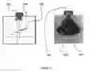Fig. 14 - Hand-held flaw detector imaging apparatus