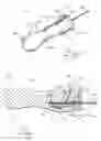 Fig. 02 - Removable/replaceable handle device