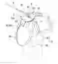 Fig. 01 - Pet lead structure