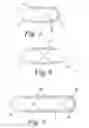 Fig. 06 - Digestible and volume adjustable multi medication delivery device