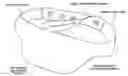 Fig. 01 - Caesarean belt