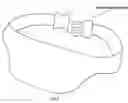 Fig. 03 - Caesarean belt
