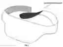 Fig. 04 - Caesarean belt