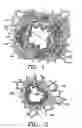 Fig. 02 - Methods for treating airways