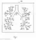 Fig. 06 - Methods for treating airways