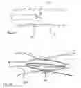 Fig. 07 - Methods for treating airways