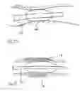 Fig. 08 - Methods for treating airways