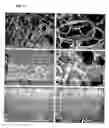 Fig. 04 - SYSTEM AND METHOD FOR TREATING BIOLOGICAL TISSUE USIING CURRET ELECTRICAL FIELD
