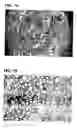 Fig. 08 - SYSTEM AND METHOD FOR TREATING BIOLOGICAL TISSUE USIING CURRET ELECTRICAL FIELD