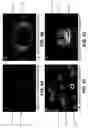Fig. 05 - Membrane filter for capturing circulating tumor cells
