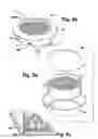 Fig. 10 - Device and method for removing solids and liquids from a pot
