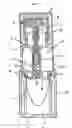 Fig. 03 - Metering pump arrangement and method for the production of a filled metering pump arrangement