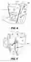 Fig. 04 - Carton with dispenser