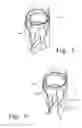 Fig. 05 - External tank sprayer pump