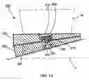 Fig. 15 - Adjustable leveling pedestal for a free-standing object