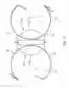 Fig. 11 - Portable devices for detachably securing cans and other objects
