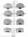 Fig. 05 - Light efficient packaging configurations for LED lamps using high refractive index encapsulants